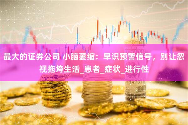 最大的证券公司 小脑萎缩：早识预警信号，别让忽视拖垮生活_患者_症状_进行性